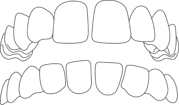 Icon showing spacing issues in teeth, teeth spaced out from each other