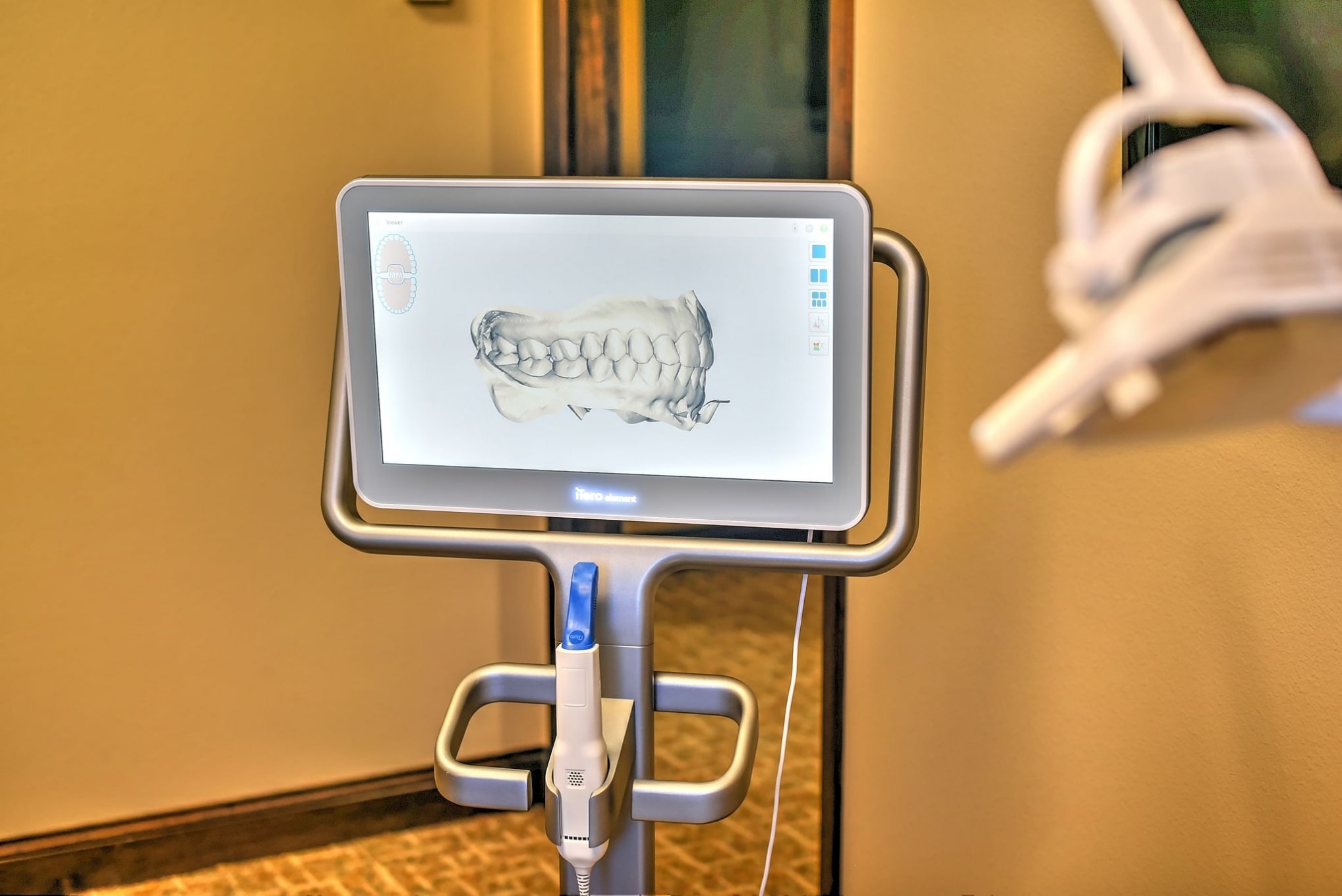 digital dental impression system, itero